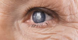 Información y consejos sobre salud: Como Acontece O Glaucoma Guia Da Farmacia