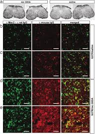 Immunohistochemistry of the spinal cord from immunized mice using... |  Download Scientific Diagram