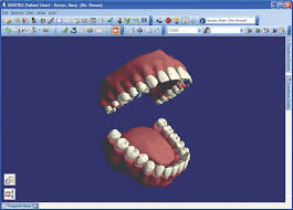 dental patient charting software management tools dentrix