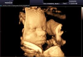 What is the difference between 3d and 4d ultrasound? The Evolution Of Ultrasounds 2d 3d 4d 5d Compared 3d 4d Ultrasound Studio Queens