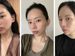 Review: Salmon Sperm Injections for Skin, Per a Beauty Writer In Korea