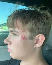 This is my friend's 17 year old nephew, Tanner. Yesterday he was enjoying a  day at Scissortail Park with his mother and younger siblings when he  noticed a person struggling in the