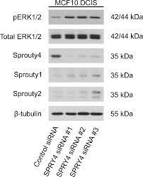 Which is the answer key to the animal cell coloring? Sprouty4 Negatively Regulates Erk Mapk Signaling And The Transition From In Situ To Invasive Breast Ductal Carcinoma