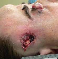 Is it possible to curve a bullet? 47 Ballistics And Gunshot Wounds Ideas Ballistics Gunshot Wounds
