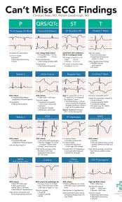 Can T Miss Ecg Findings Cards For The Emergency Medicine Provider Cards Ecg Emergency Findings Medic Cardiac Nursing Icu Nursing Nursing School Survival