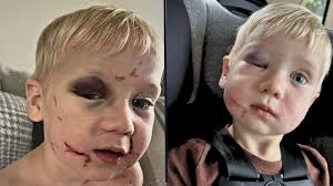 Young Boy Rallies Troop of Runners Including Wounded Vet