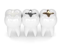 Choose from car insurance roadside packages or aaa. West County Smile Providing Dental Fillings Services In Chesterfield