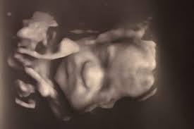 Fundraiser by Corey Coles-Perez : Baby Chandler's Heart Surgery NICU