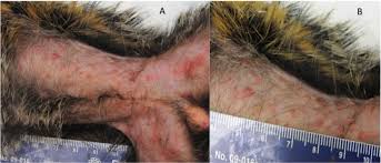 Human monkeypox often begins with a combination of the following symptoms: Plos Neglected Tropical Diseases Intranasal Monkeypox Marmoset Model Prophylactic Antibody Treatment Provides Benefit Against Severe Monkeypox Virus Disease