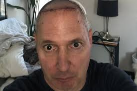 Fundraiser by Mitchell Oringer : Parkinson's Surgery