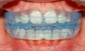 Myobrace Melbourne Joined With Right Gulping And Right Breathing Examples Will Grow Full Curves Which Is Best For Any Orthodontics Let Them Talk Dentistry