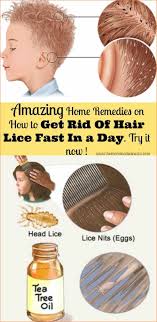 How To Get Rid Of Head Lice In One Day Hair Lice Head Louse Lice Removal