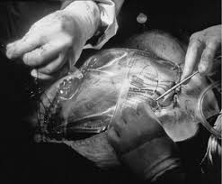 Another advantage to the bogota bag, is that the abdominal contents can be visually inspected. Intra Abdominalhypertension And Abdominal Compartment Syndrome Chapter 172 Essential Clinical Anesthesia