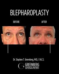 Little tweaks for a major confidence boost!🔥 We offer so many options at  Greenberg Cosmetic Surgery to help tweak any areas