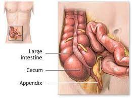 Sakit perut adalah sebuah penyakit yang sudah umum dan pasti anda dan saya pernah mengalaminya, banyak faktor yang menyebabkan terjadinya sakit perut seperti makanan dan minuman yang tidak sehat, masuk angin, gas yang berlebihan didalam lambung. B Jue Corner Sakit Perut Ketahui 10 Simptom Radang Appendik