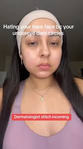 Tired of flakes and dandruff? Here's how to get rid of dandruff and dry  scalp from a board-certified dermatologist. #dandruff #dryscalp  #dandrufftreatment #fyp