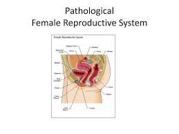 Structures of reproductive anatomy may look different, but their functions are very similar. Ppt Pathological Female Reproductive System Powerpoint Presentation Free Download Id 2159124