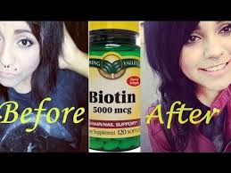 Biotin Hair Growth Results Before And After Hair Growth Biotin 5000mcg Cocnut Oil Biotin Reviews Biotin Hair Growth Biotin Hair Growth Results Biotin Hair Growth Vitamins