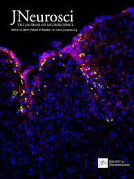 Cortical Zinc Signaling Is Necessary for Changes in Mouse Pupil Diameter  That Are Evoked by Background Sounds with Different Contrasts | Journal of  Neuroscience