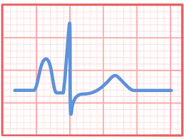 Image result for Q Wave