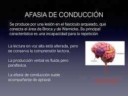 Check spelling or type a new query. Afasia Sesion Clinica Speaker Deck