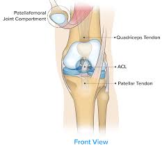 This guide will help you understand. Complete Guide To Knee Pain Spring Loaded Technology