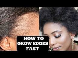 How To Grow Your Thin Bald Edges In 3 Days Guaranteed Youtube Grow Edges Thinning Edges Regrow Edges