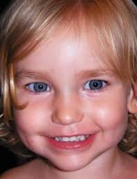 Inheriting Eye Colors from Parents