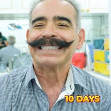 Traveling for Dental Implants