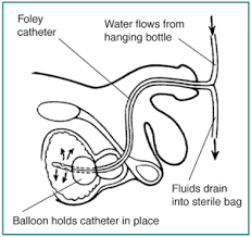 Pin By Evelyn Cooley On Nurse Pathophysiology Nurse Quotes Benign Prostatic Hyperplasia Medical Field