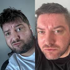 Still struggling. But cut down from 350+ units of Booze plus coke, meth,  ket, G. Whatever I could get. The difference in my face is keeping me going  trying to go at
