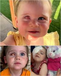 Ava's bravery with childhood eye cancer