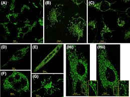 There will be an option to reload the while i agree that carriers or bb should have the older os available for those who find issues with. Mitochondria And Reactive Oxygen Species In Aging And Age Related Diseases Sciencedirect