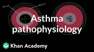 asthma pathophysiology video asthma khan academy