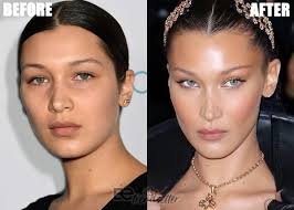 You can't underestimate what makeup. Bella Hadid Plastic Surgery Secrets Exposed 2020