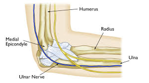 Doctors perform this procedure to fix an ulnar collateral ligament, otherwise known as a ucl, in the elbow if it's torn — which begs the next question: What Exactly Is Tommy John S Surgery Total Orthopedics Sports Medicine