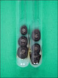 Fonsecaea pedrosoi (brumpt) negroni, 1936. Chromoblastomycosis Caused By Fonsecaea Pedrosoi Scienceopen