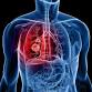 Lung Cancer Study Day event image