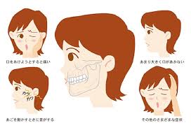 顎関節症の症状　歯医者　関連痛