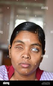 Blind people in india hi-res stock photography and images