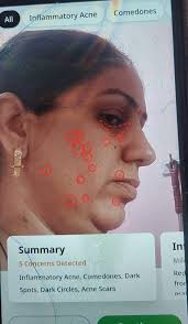 Meet Abbi: The Future of Personalized Skincare Skincare isn't  one-size-fits-all—so why settle for generic products? Abbi is 100%  customized skincare, powered by proprietary AI digital skin analysis.  Here's how it works: 🔅Take