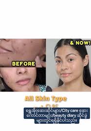 50ml:39500 #Hotline :09-441151991