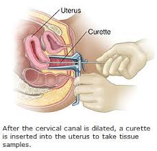 A hydrated person should have light, almost. Moms Hub How To Tell If You Re Dilated