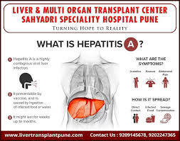 Your best bet is to make yourself aware of the signs and symptoms, some of which are less talked. Pin On Liver Transplant Surgeon In Pune