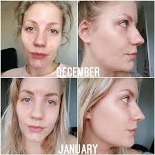 It has the most minimalistic and truest description on its products ever. The Ordinary Whitening Skin Beauty Serum Niacinamide 10 Zinc 1 30ml Shopee Malaysia