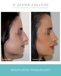 Dr. Javier Collado (@doctorjaviercollado) · Málaga