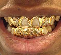 An Entry From Ray Dennis Curated Grillz Gold Grillz Grillz Teeth