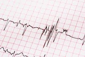 ekg results for a fib characteristics types symptoms and