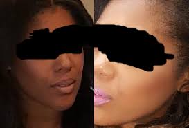 Genuine Black And White Bleaching Cream Reviews Black And White Bleaching Cream Uses Side Effect And Review News Shantou Shiweiya Cosmetics Industry Co Ltd