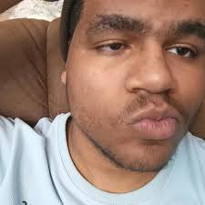 Fanum does a face reveal just hours after getting a bad allergic reaction  😭👏